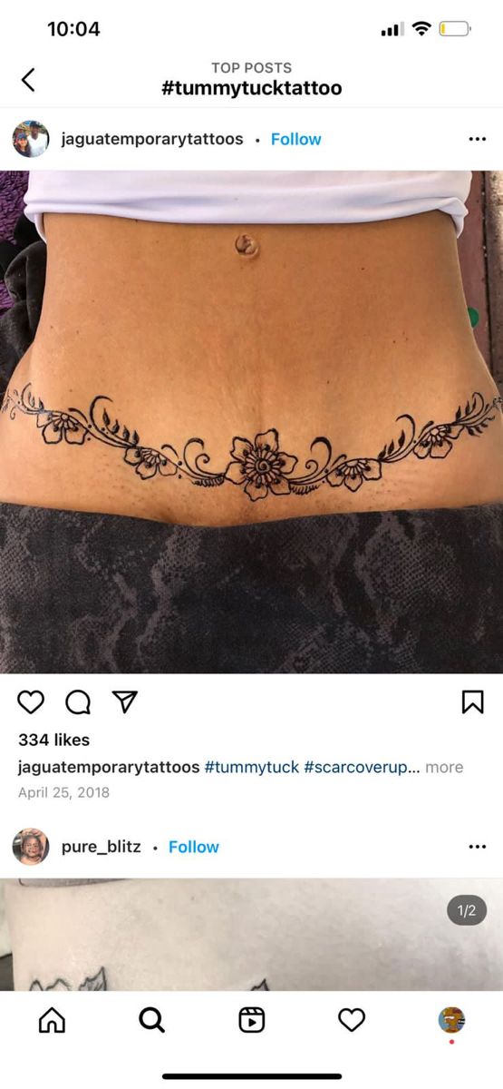 14 Stunning Tummy Tuck Tattoo Cost Image Ideas