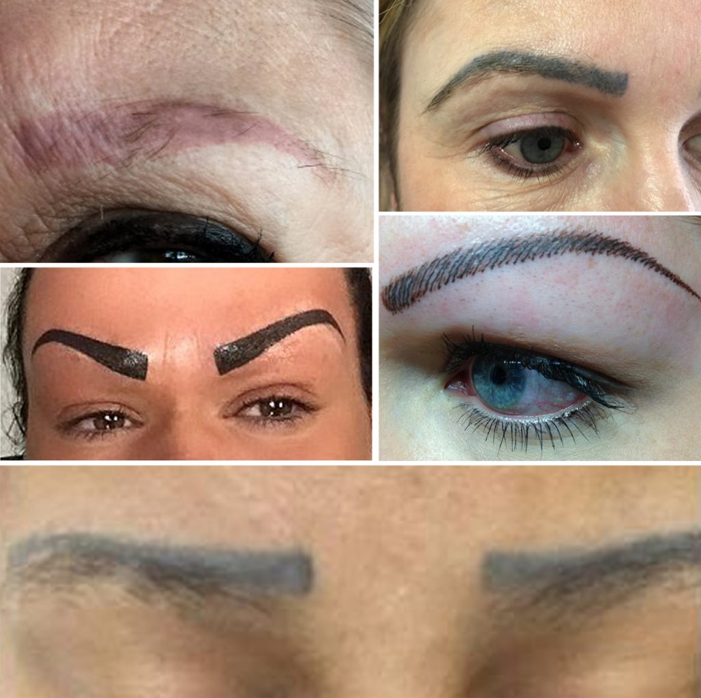 Eyebrow Tattoo Before And After