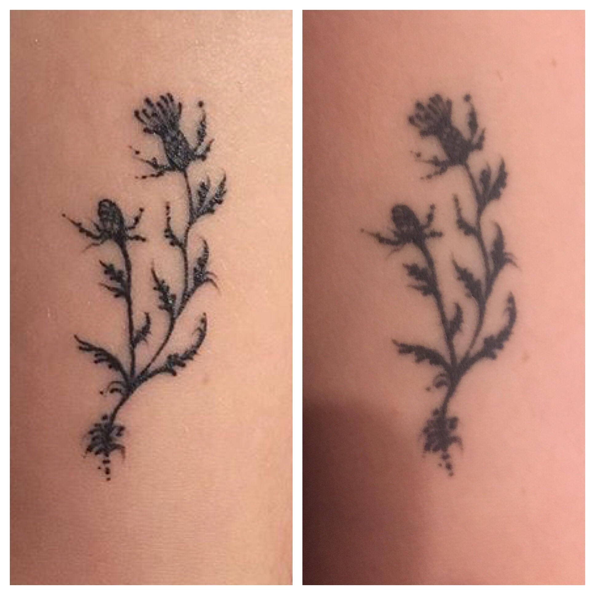 5 Tips for Maintaining Fine Line Tattoos as They Age