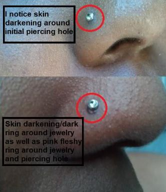 Healing Stages Of Nose Piercing Top Piercing Ideas