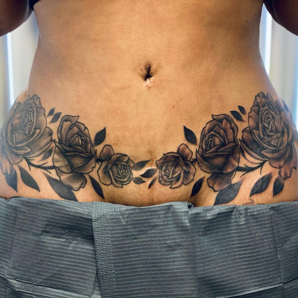 Tummy Tuck Tattoo