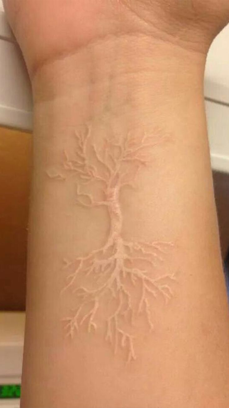 White Tree Of Gondor Tattoo Done In White Ink White Tattoo White Ink